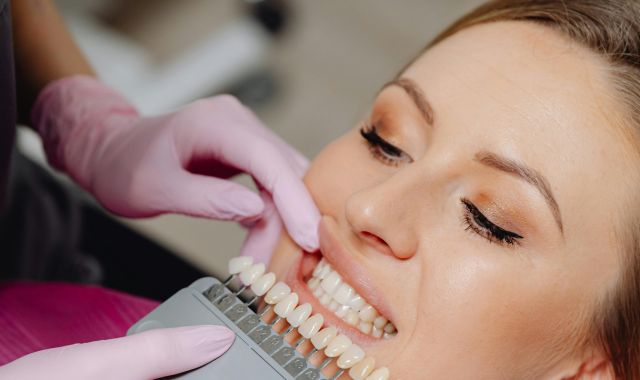 teeth whitening